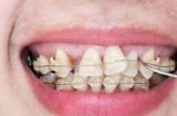高加索犬牙齿护理之关键知识