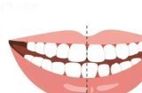 如何护理你的凯利蓝梗的牙齿？（宠物牙齿健康的重要性，减少疾病的发生，刷牙技巧和预防措施。）